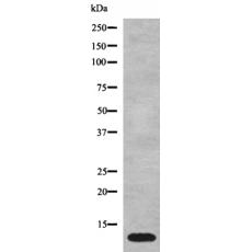 兔抗MT-ATP8多克隆抗體