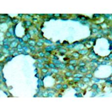 兔抗PAK1 (Phospho-Thr212)多克隆抗體