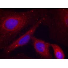 兔抗PAK1 (Phospho-Thr212)多克隆抗體