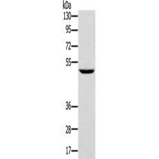 兔抗TRIM31多克隆抗體