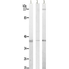 兔抗PPP1R2(Ab-44)多克隆抗體