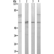 兔抗PFKFB1多克隆抗體