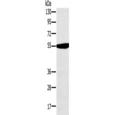 兔抗OXCT1多克隆抗體