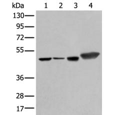 兔抗PLAG1多克隆抗體