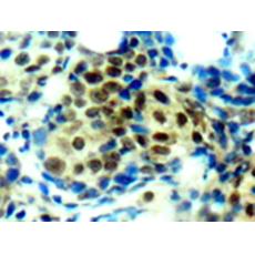 兔抗MAPK1 MAPK3 (Phospho-Thr185 202)多克隆抗體