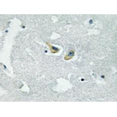 兔抗NCF1(Phospho-Ser345)多克隆抗體