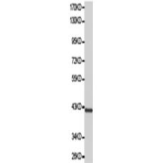 兔抗NCF1多克隆抗體