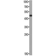 兔抗NR1H3多克隆抗體