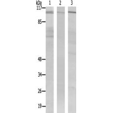 兔抗NCOA7多克隆抗體