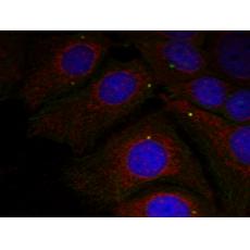 兔抗SNCA (Phospho-Tyr125)多克隆抗體