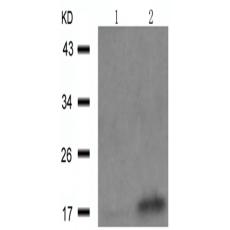 兔抗SNCA (Phospho-Tyr125)多克隆抗體