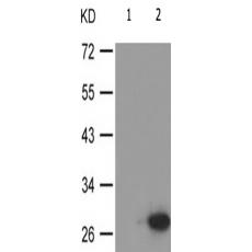 兔抗TNNI3(Phospho-Thr142)多克隆抗體