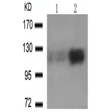 兔抗PTK2 (phospho-Tyr576 Tyr577)多克隆抗體