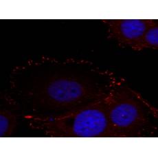 兔抗PTK2 (phospho-Tyr576 Tyr577)多克隆抗體