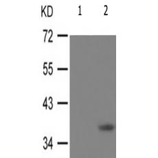 兔抗NFKBIB(Phospho-Thr19)多克隆抗體