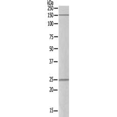 兔抗TMEM101多克隆抗體