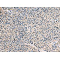 兔抗RNASE1多克隆抗體  