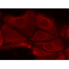 兔抗RPS6KB1 (Phospho-Ser411)多克隆抗體    