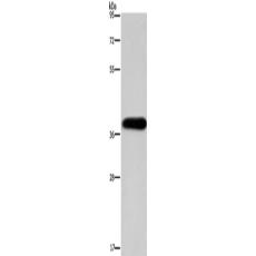 兔抗PITX2多克隆抗體