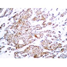 兔抗MYC (Phospho-Thr58)多克隆抗體