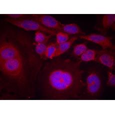  兔抗STAT3 (Phospho-Ser727)多克隆抗體    