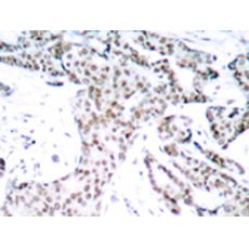  兔抗STAT3 (Phospho-Ser727)多克隆抗體    