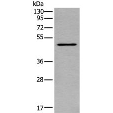 兔抗TRDMT1多克隆抗體