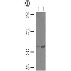 兔抗SMAD2 (Phospho-Ser467)多克隆抗體 