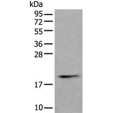 兔抗PTP4A1多克隆抗體