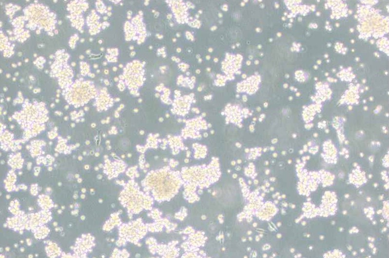 B95-8絨猴EB病毒轉化的白細胞